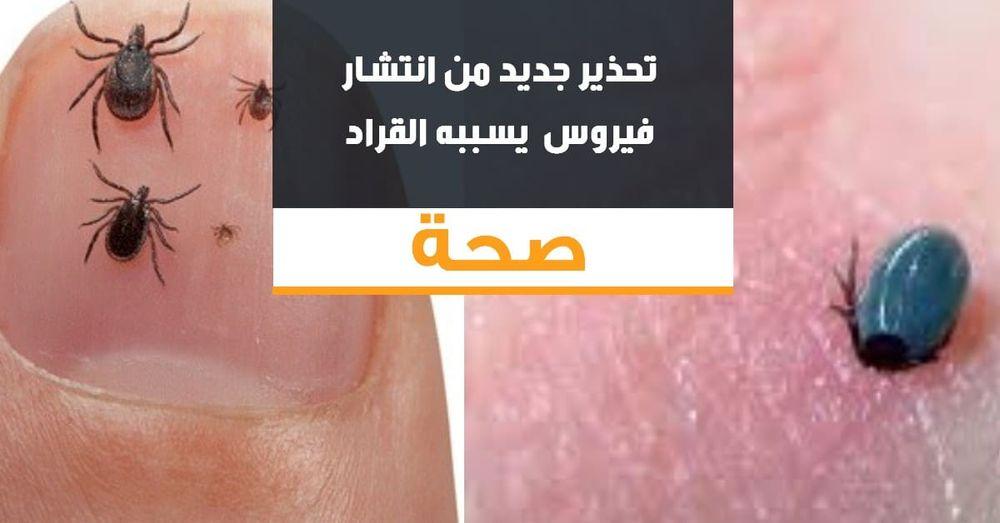 تحذير جديد من انتشار فيروس TBE وبكتيريا البوريليا جراء القراد