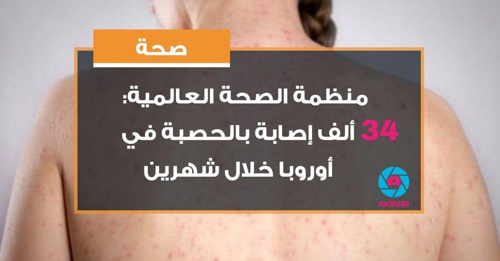 منظمة الصحة العالمية: 34 ألف إصابة بالحصبة في أوروبا خلال شهرين