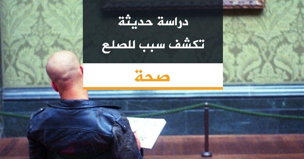 دراسة حديثة تكشف سبب للصلع