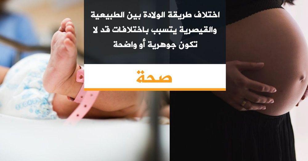 اختلاف طريقة الولادة بين الطبيعية والقيصرية يتسبب باختلافات قد لا تكون جوهرية أو واضحة