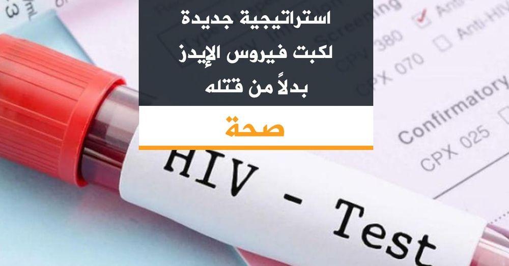 استراتيجية جديدة لكبت فيروس الإيدز بدلاً من قتله