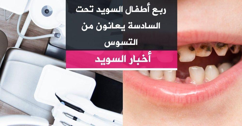 ربع أطفال السويد تحت السادسة يعانون من التسوس