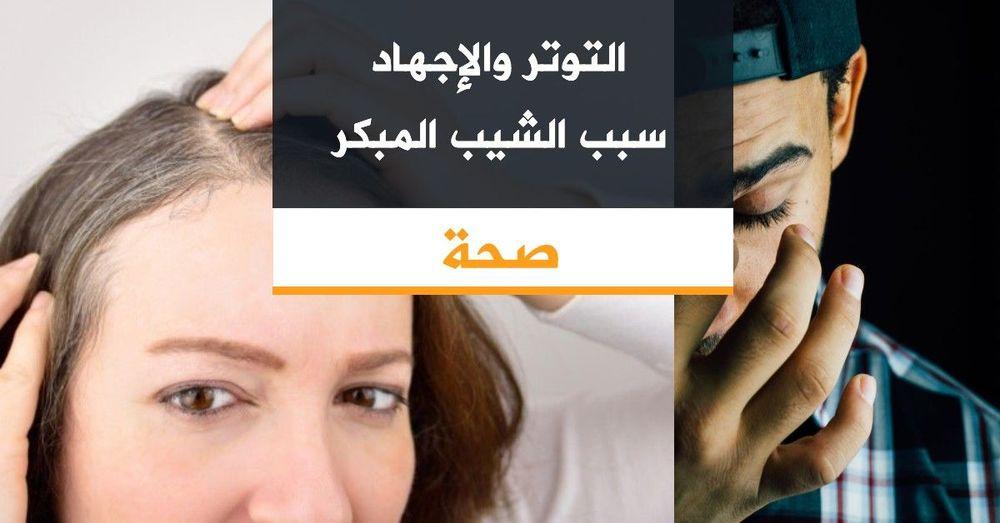 التوتر والإجهاد سبب الشيب المبكر