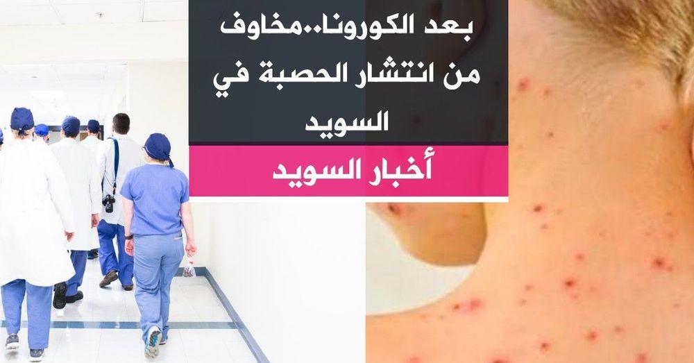 بعد الكورونا..مخاوف من انتشار الحصبة في السويد