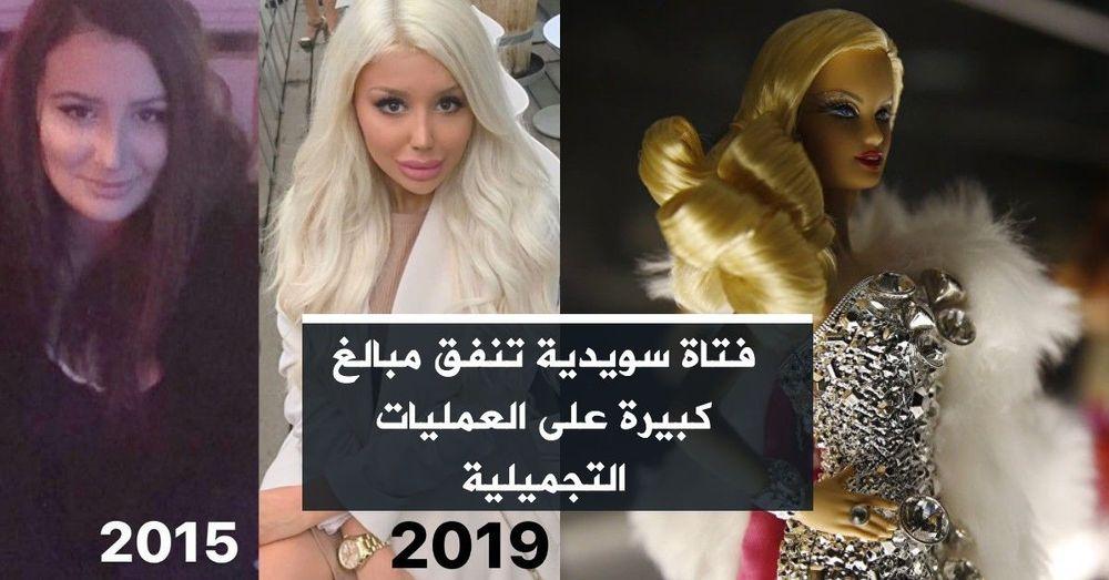 فتاة سويدية تنفق مبالغ كبيرة على العمليات التجميلية