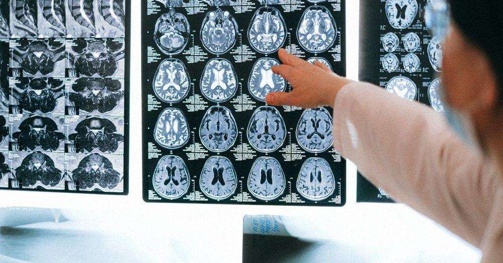تأخر تشخيص الآلاف من حالات السرطان أثناء الوباء
