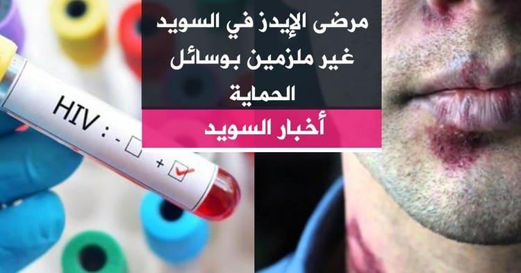 مرضى الإيدز في السويد غير ملزمين بوسائل الحماية