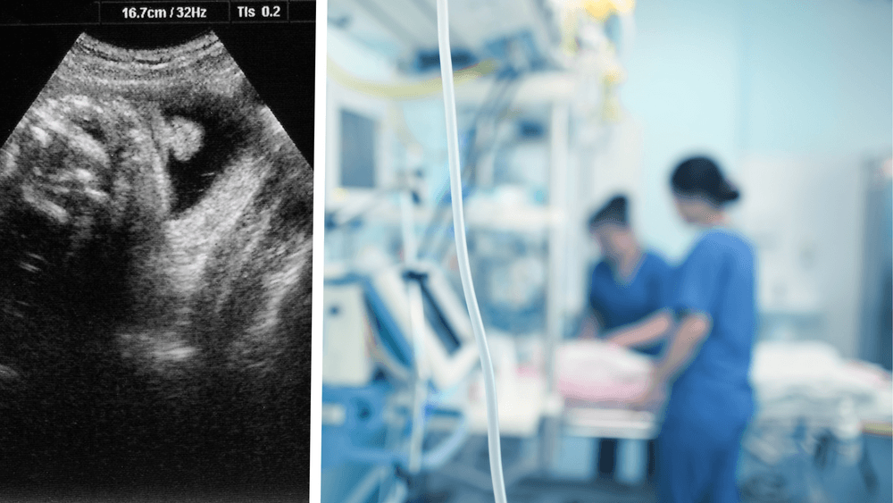 امرأة حامل تلقت تشخيصاً خاطئاً أدى لوفاة جنينها في السويد