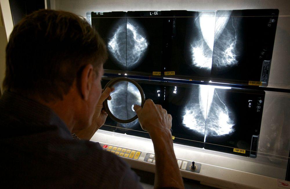 شهر التوعية بسرطان الثدي: دراسة جديدة حول الناجيات من سرطان الثدي
